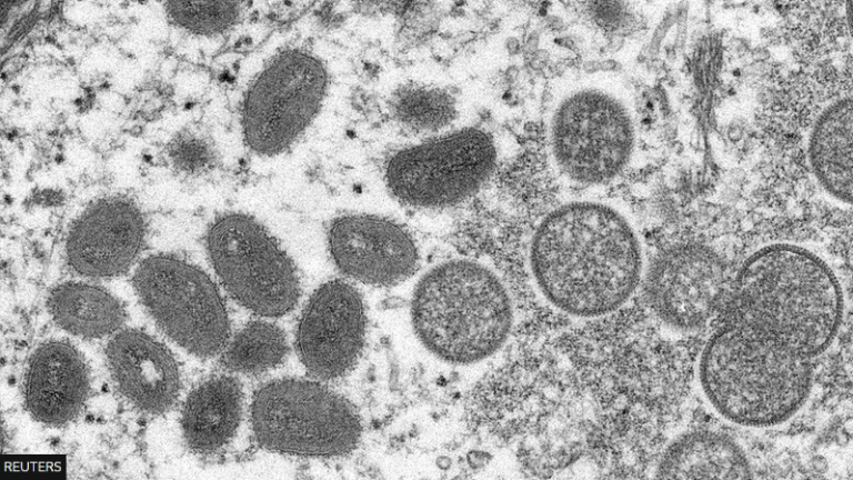 Cases Of Monkeypox Have Risen As The CDC Advises Infected People To Abstain From Sex.